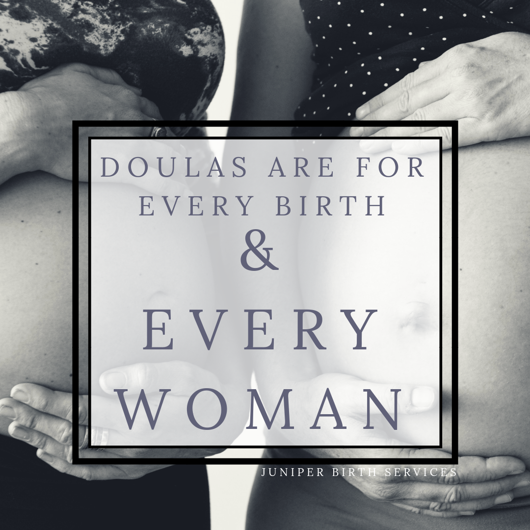 Doula Support is for Every Birth