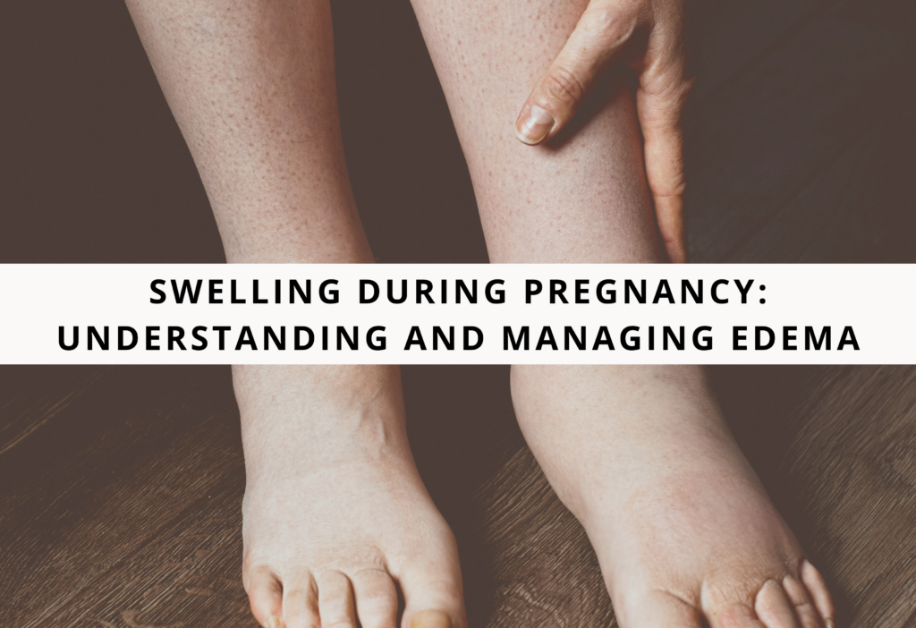 Swelling During Pregnancy: Understanding and Managing Edema