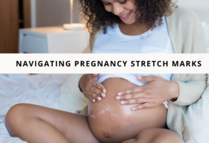 Navigating Pregnancy Stretch Marks