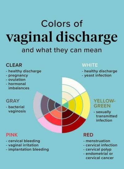 colors of vaginal discharge